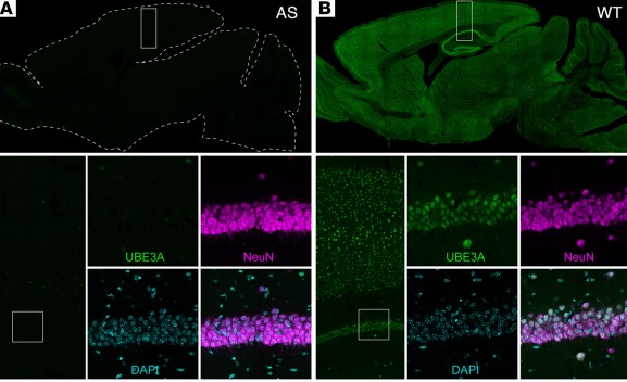 Molekulare und Verhaltensfolgen einer Überdosierung des Ube3a-Gens bei Mäusen